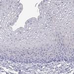 FAM101A Polyclonal Antibody