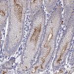 FAM101A Antibody in Immunohistochemistry (Paraffin) (IHC (P))