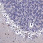 PCDHA6 Polyclonal Antibody