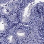 CPNE4 Polyclonal Antibody