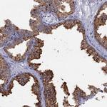 CPNE4 Antibody in Immunohistochemistry (Paraffin) (IHC (P))