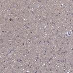 Synaptotagmin 5 Antibody in Immunohistochemistry (Paraffin) (IHC (P))