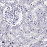 ALOXE3 Antibody in Immunohistochemistry (Paraffin) (IHC (P))