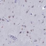 TBR1 Antibody in Immunohistochemistry (Paraffin) (IHC (P))