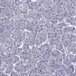 TBR1 Antibody in Immunohistochemistry (Paraffin) (IHC (P))