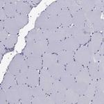 TBR1 Antibody in Immunohistochemistry (Paraffin) (IHC (P))