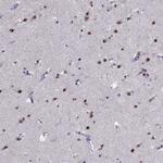 TBR1 Antibody in Immunohistochemistry (Paraffin) (IHC (P))