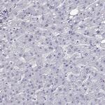 TBR1 Antibody in Immunohistochemistry (Paraffin) (IHC (P))
