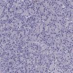 TBR1 Antibody in Immunohistochemistry (Paraffin) (IHC (P))