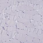 TBR1 Antibody in Immunohistochemistry (Paraffin) (IHC (P))