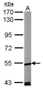 RORA Polyclonal Antibody