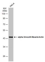 Alpha-Smooth Muscle Actin Antibody in Western Blot (WB)