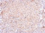 PSA Antibody in Immunohistochemistry (Paraffin) (IHC (P))
