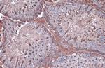 GAPDH Antibody in Immunohistochemistry (Paraffin) (IHC (P))