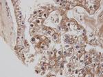 Cannabinoid Receptor 1 Antibody in Immunohistochemistry (Paraffin) (IHC (P))