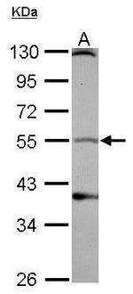 DRD1 Antibody in Western Blot (WB)