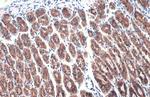 E-cadherin Antibody in Immunohistochemistry (Paraffin) (IHC (P))
