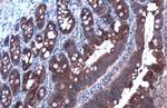 E-cadherin Antibody in Immunohistochemistry (Paraffin) (IHC (P))