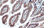 E-cadherin Antibody in Immunohistochemistry (Paraffin) (IHC (P))