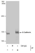 E-cadherin Antibody in Immunoprecipitation (IP)