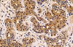 MUC1 Antibody in Immunohistochemistry (Paraffin) (IHC (P))