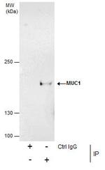 MUC1 Antibody in Immunoprecipitation (IP)