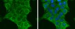 PIK3CA Polyclonal Antibody