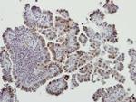 MDM2 Polyclonal Antibody