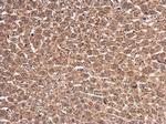 WT1 Antibody in Immunohistochemistry (Paraffin) (IHC (P))