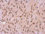 Metadherin Antibody in Immunohistochemistry (Paraffin) (IHC (P))