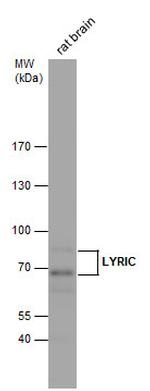 Metadherin Antibody in Western Blot (WB)