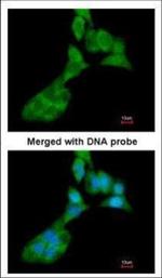MMP3 Polyclonal Antibody