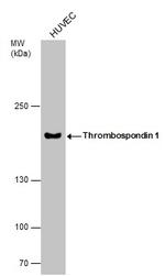 Thrombospondin 1 Polyclonal Antibody