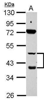 RARB Polyclonal Antibody