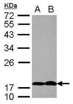 PTHLH Antibody in Western Blot (WB)