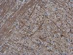 Collagen II Polyclonal Antibody