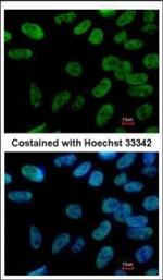 Nanog Antibody in Immunocytochemistry (ICC/IF)