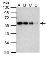 Cyclin B1 Antibody in Western Blot (WB)