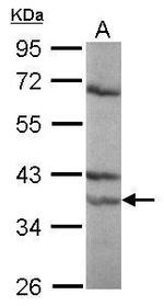 RARA Antibody in Western Blot (WB)