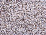 Zap-70 Antibody in Immunohistochemistry (Paraffin) (IHC (P))