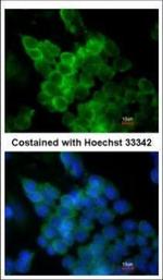 LPL Polyclonal Antibody