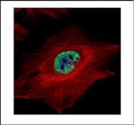 MLH1 Polyclonal Antibody