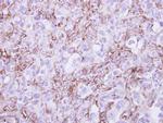 G6PD Polyclonal Antibody