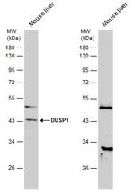 MKP-1 Polyclonal Antibody