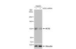 ACE2 Antibody in Western Blot (WB)