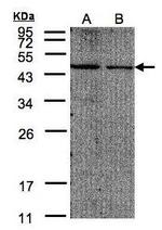 eIF4A2 Polyclonal Antibody