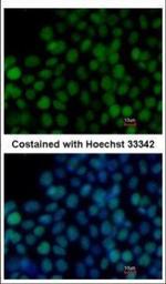 SOX2 Antibody in Immunocytochemistry (ICC/IF)