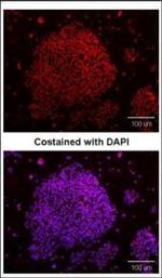 SOX2 Antibody in Immunocytochemistry (ICC/IF)