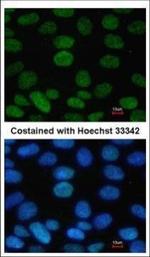 SOX2 Antibody in Immunocytochemistry (ICC/IF)