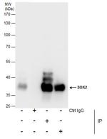 SOX2 Antibody in Immunoprecipitation (IP)